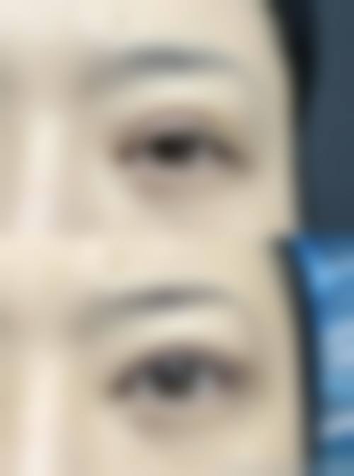 江西鹰潭美嘉整形详细的预约挂号方式及流程