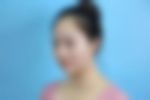 其他地区骨粉取出干净的医院