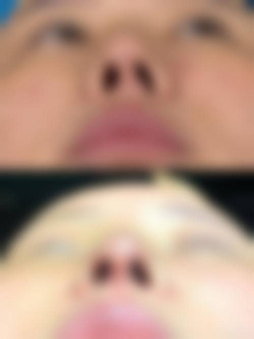 选择骨粉取出医院的要点