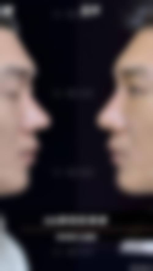 广州地区骨粉取出干净的医院