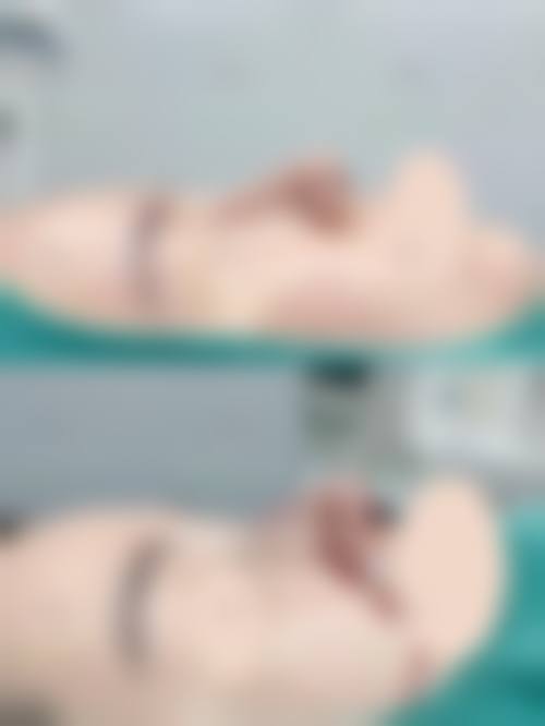 北京地区骨粉取出干净的医院