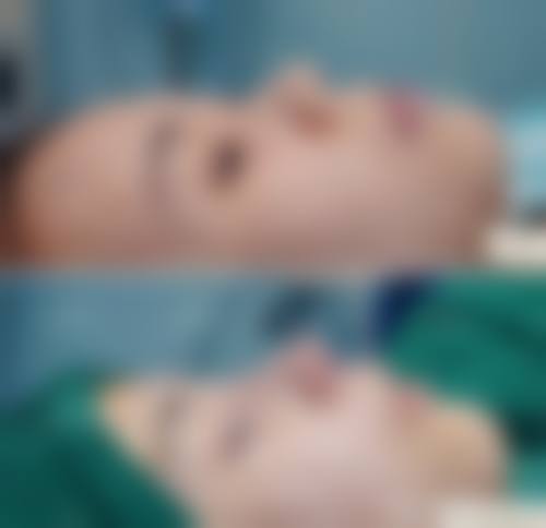 金亨洙医生擅长项目