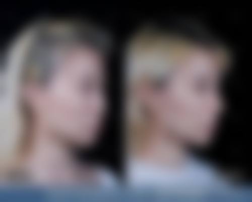 金亨洙医生价格表