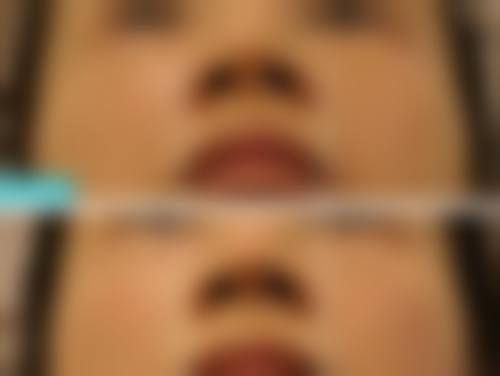 江阴市人民医院特色项目及技术优势