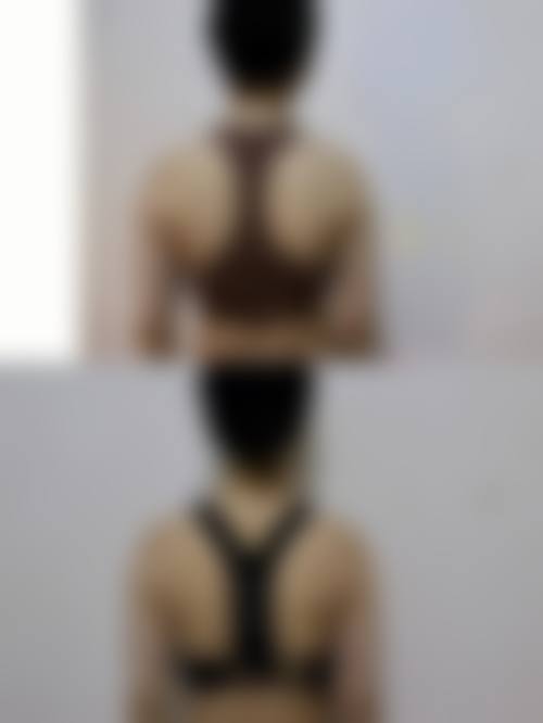 赵帆影医生口碑评价及真人实例