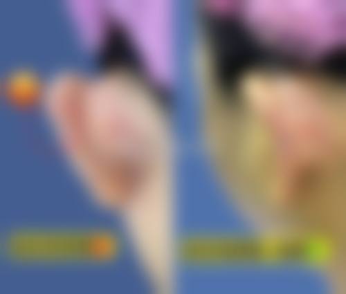 深圳嘎纳医疗美容门诊部真人口碑评价怎么样？