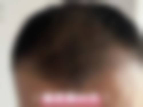 赵磐琳医生口碑评价及真人实例