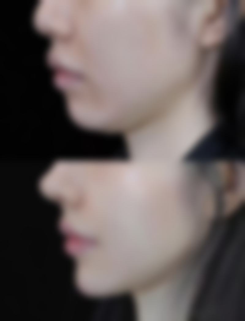 洛阳维多利亚整形：个性化服务受认可