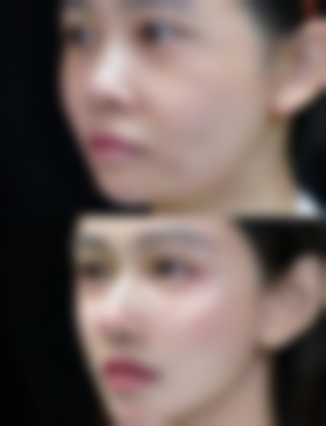 赵帆影医生技术优势