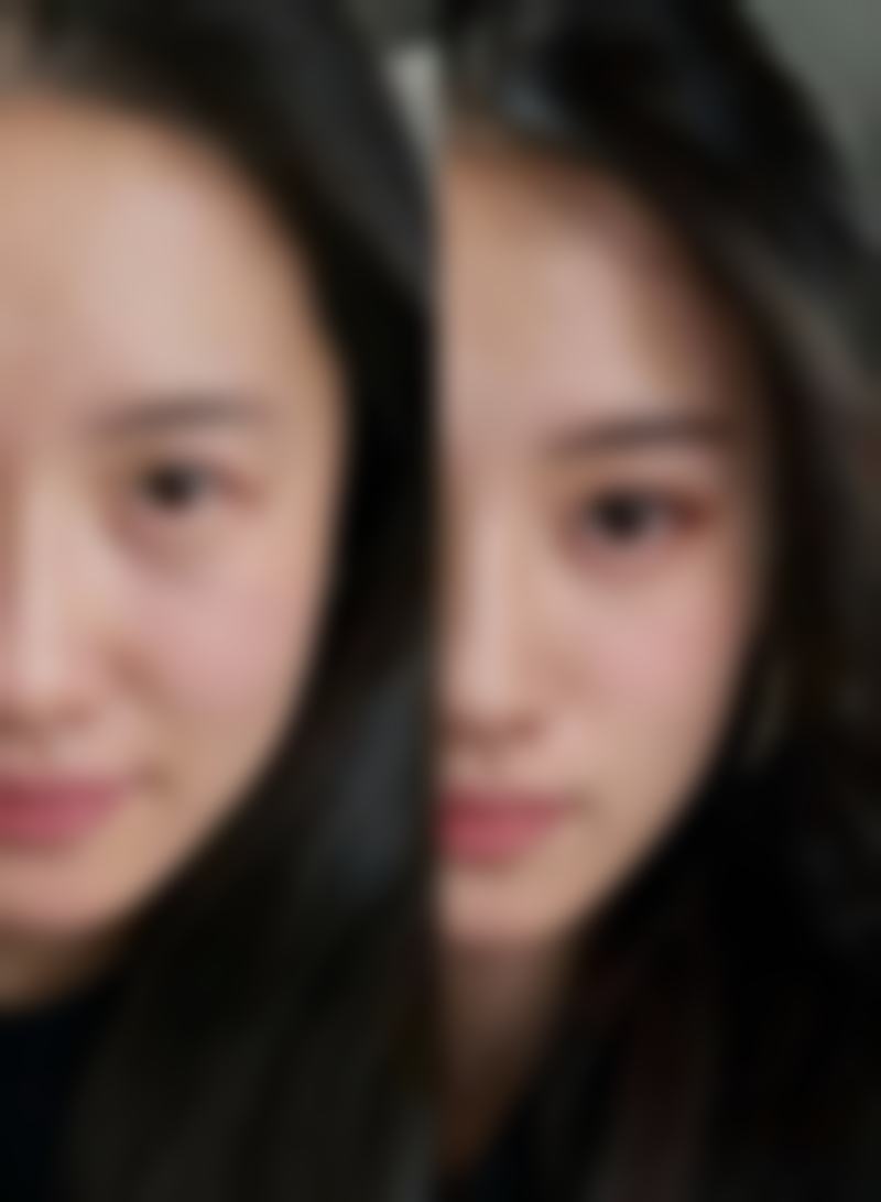 乐山圣泊医疗美容诊所真人口碑评价怎么样？