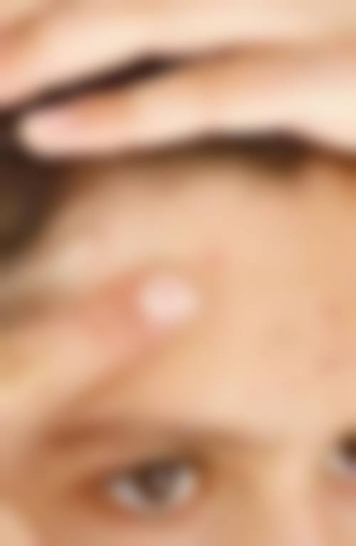 成都润禾皮肤病专科医院特色项目及技术优势