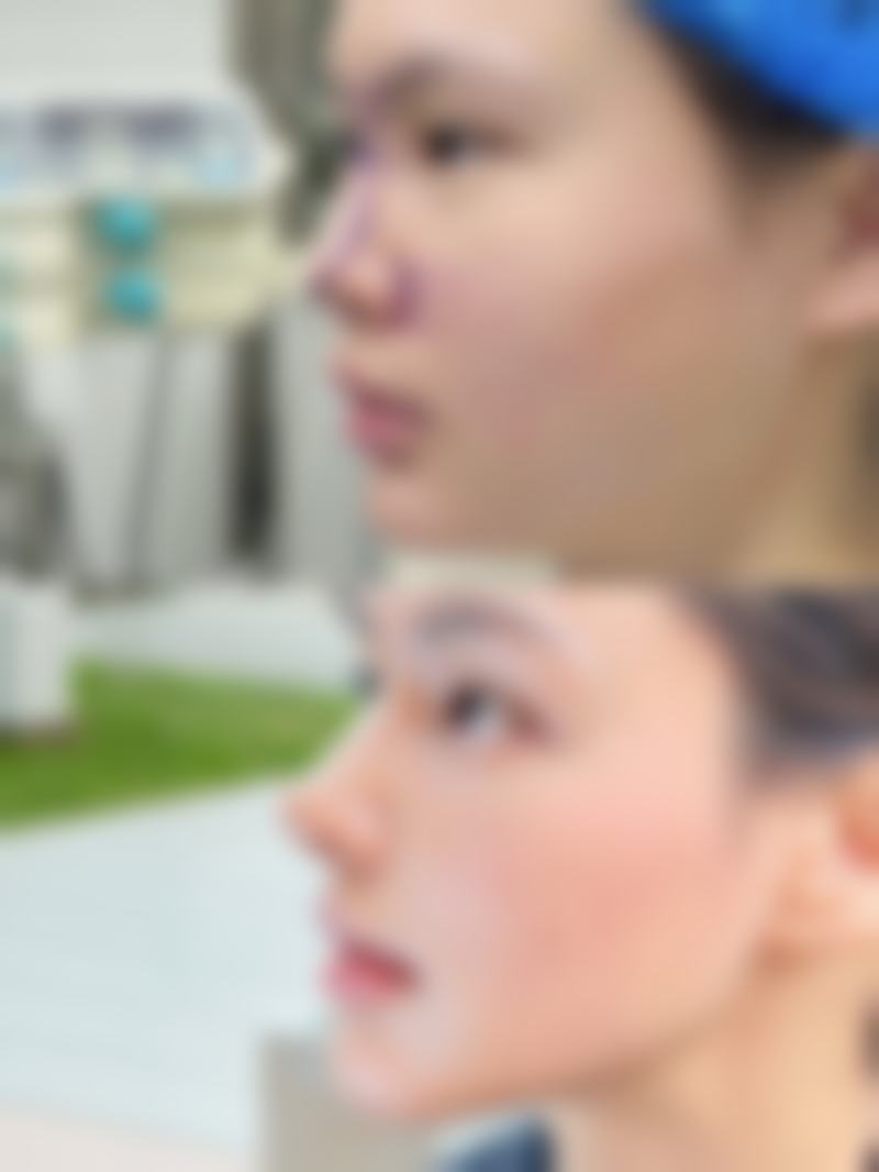 成都蓉雅晶肤医疗美容门诊部真人口碑评价怎么样？