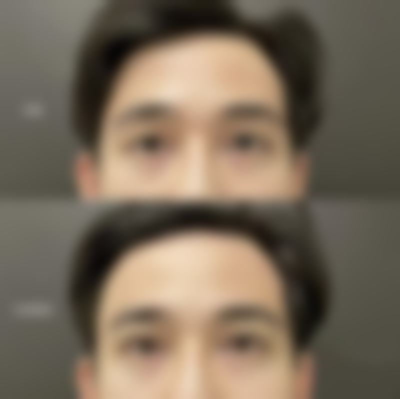 三、台州其他双眼皮手术医院特色