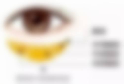 成都米兰柏羽眼部综合手术价格