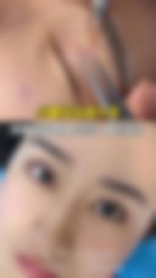 温州艺星整形哪位医生做眼综合好些？林文君偏魅惑，黄乐走自然，谭立文经验足