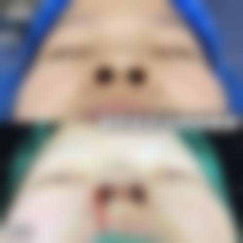 菏泽佳慕医疗美容门诊部价目表