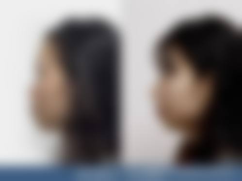 成都美上美整形医疗美容医院擅长项目