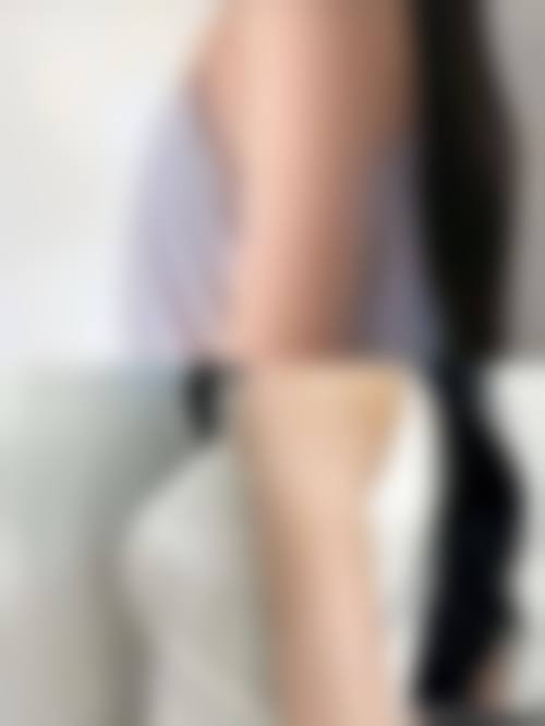 上海康丽整形外科医院真实实例