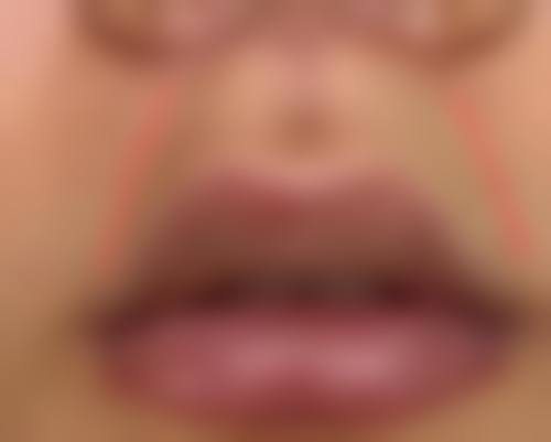 上海娜美整形：性价比高的整形之选