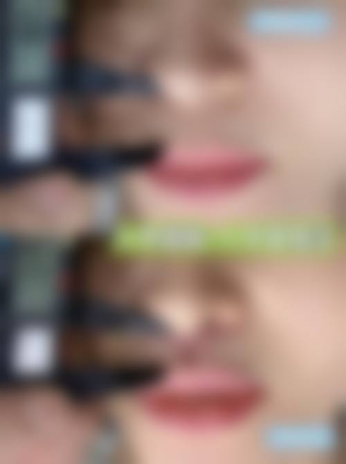 上海艺星医疗美容医院：眼部与毛发移植的专精机构