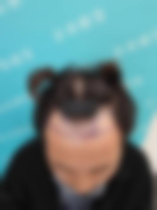 八、青岛海伦整形美容真人口碑评价怎么样？