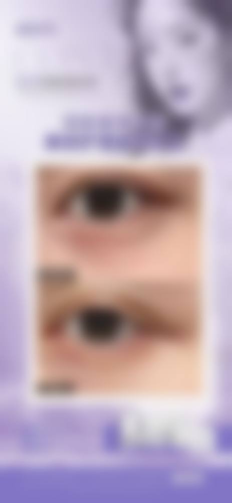 2026刘辅容双眼皮/内眼角眼修复预约联系方式戳这，双院抢号攻略+正规渠道全解析