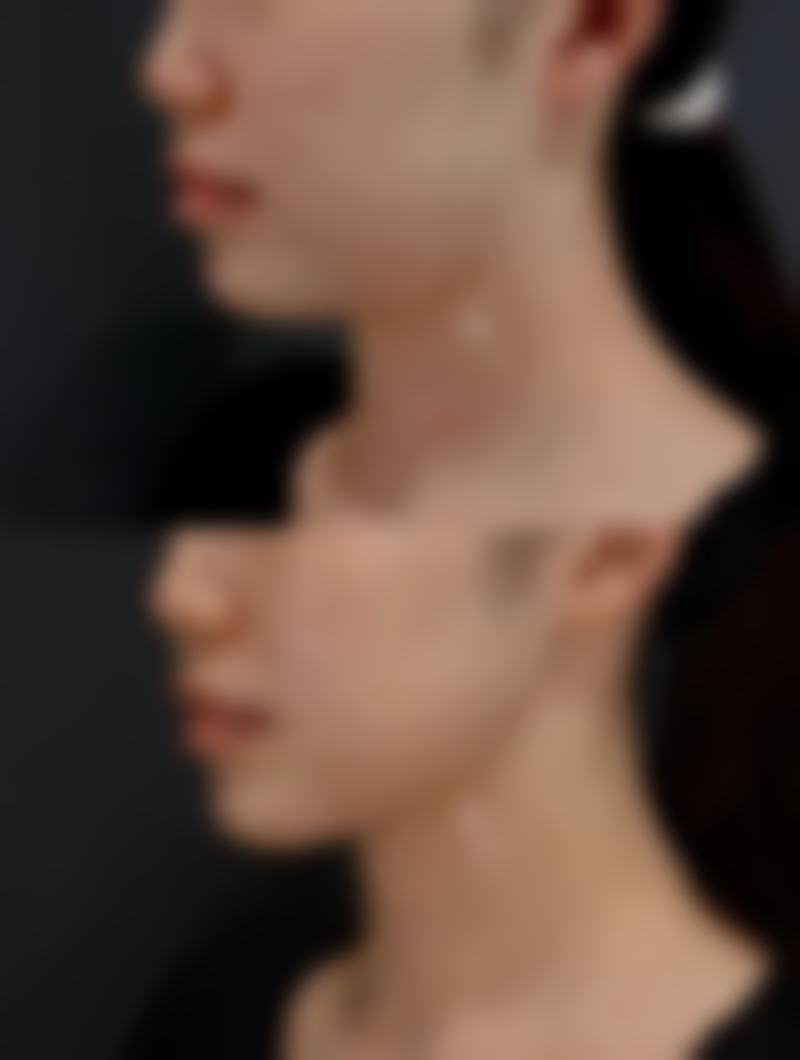 庄洪兴医生适合就医人群