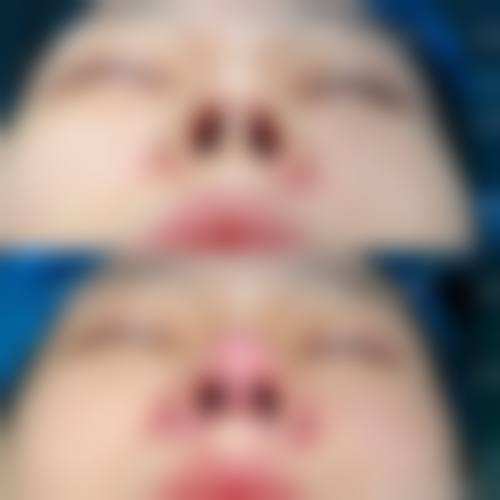 龙始恩医生口碑评价及真人实例