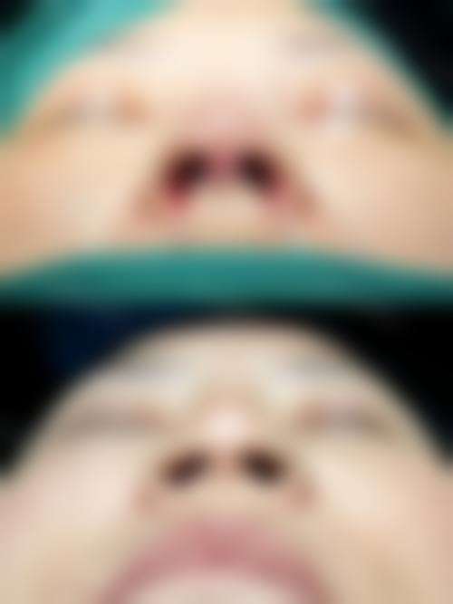 韩国MD整形医院——专精隆胸的老牌劲旅