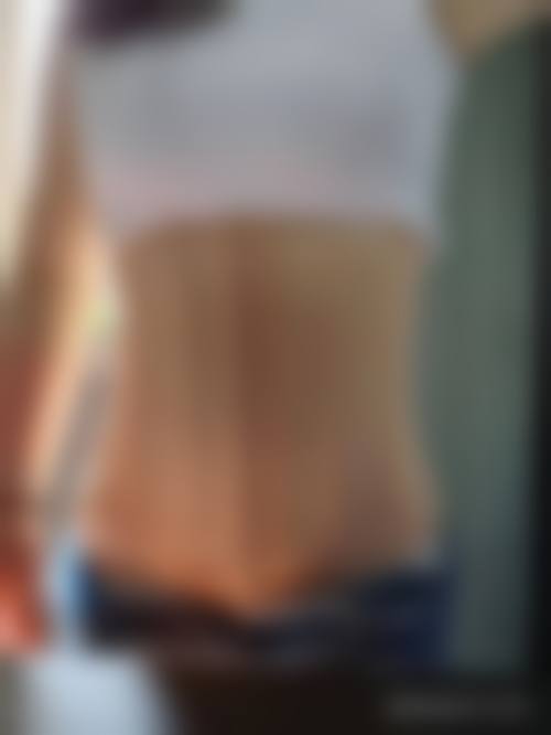 四、深圳人民医院大腿抽脂的术前注意事项