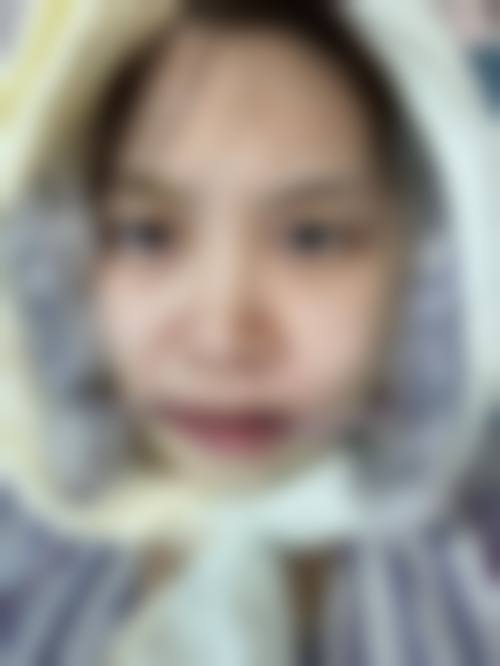 韩国ID整形医院——面部轮廓整形的翘楚