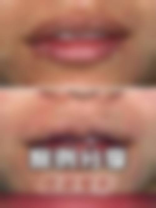 青岛熙妍丽整形医院特色项目及技术优势