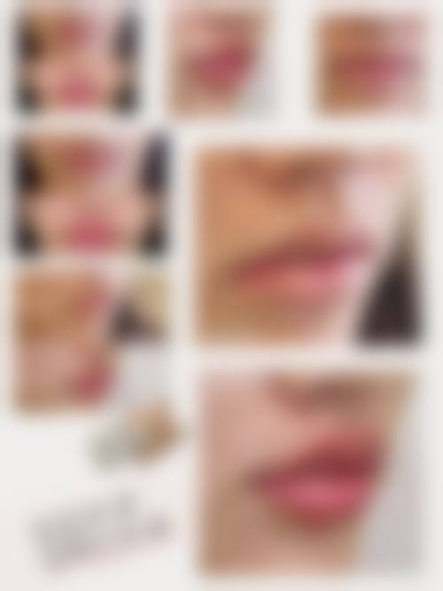 杭州艺星李俊霞幼态脸打造之面部轮廓塑形价格