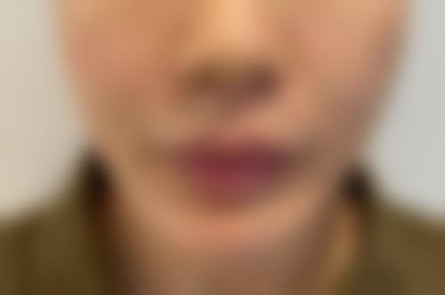 六、四川成都医美整形医院价格区间及收费说明