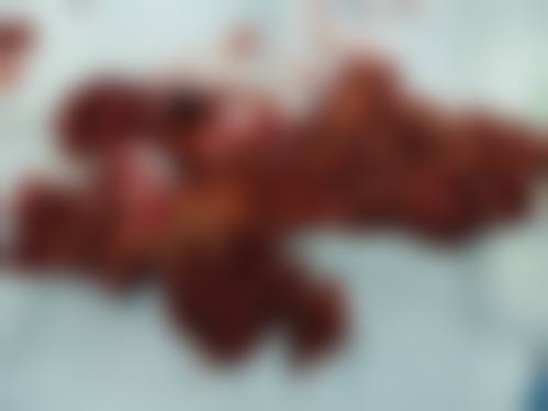 深圳富华唐新辉曼托假体隆胸价格合理