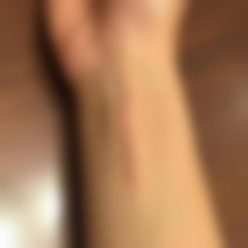 五、重庆军科医院疤痕修复中 心的成功实例