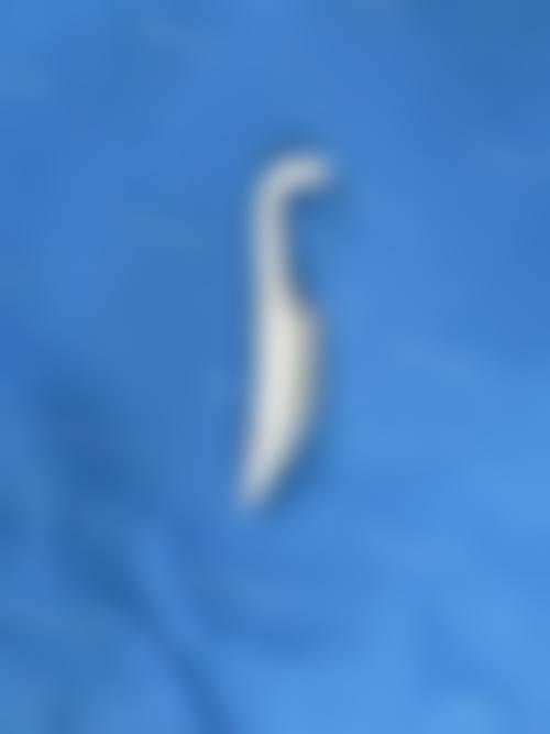 烟台奥拉克医疗美容口碑如何？