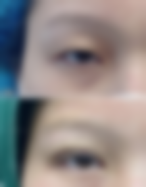 烟台奥拉克医疗美容价格表 / 收费标准一览