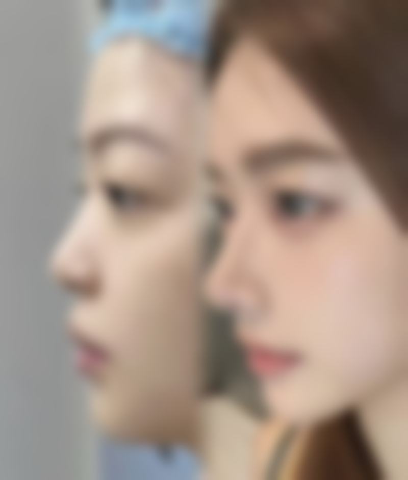 赣州市皮肤病医院医学激光美容整形中 心擅长项目