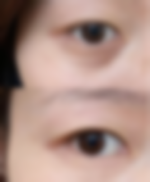 赣州市皮肤病医院医学激光美容整形中 心价格表