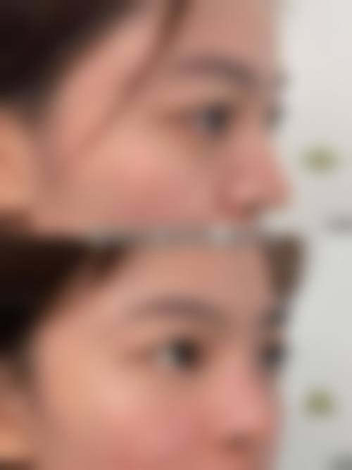 北京整形专家排名：沃尔、柏丽上榜，刘彦军、李劲良领衔，鼻整形案例自然，7万起获好评