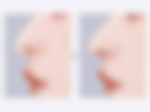 北京知音医疗美容——李奇军骨干医生