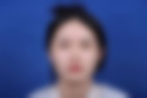 北京米扬丽格医疗美容——巫文云骨干医生