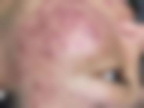 三、南京皮肤研究所蒋王庙院区挂号攻略