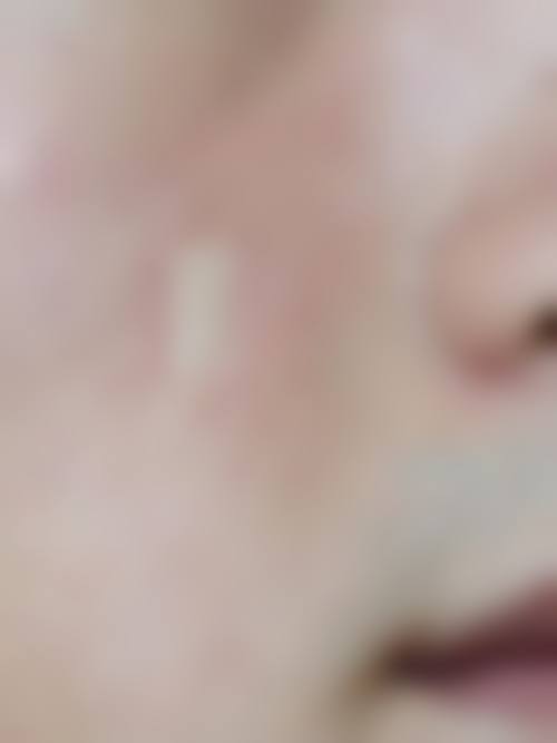 手术修复疤痕要花多少钱