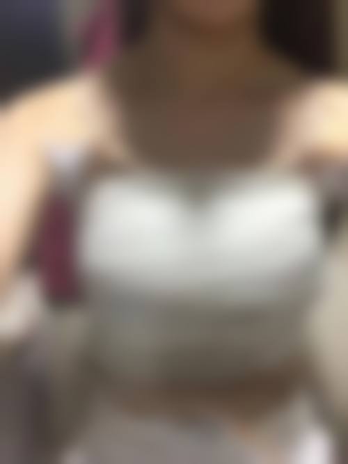 五、术后定期回访的贴心服务