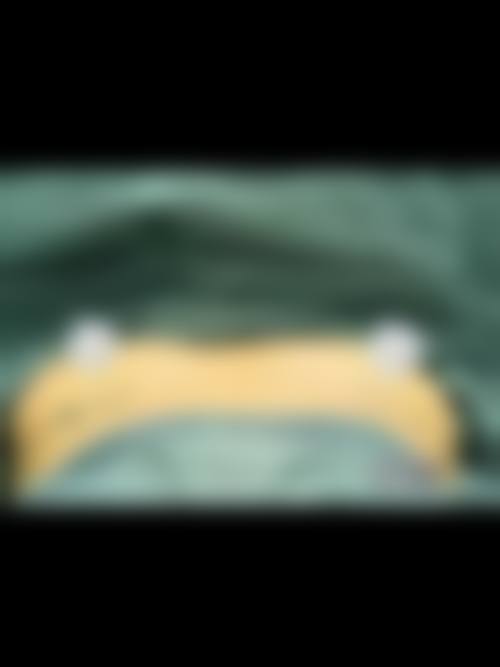 七、哈尔滨华运医疗美容收费价格表/收费标准