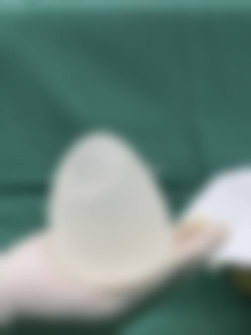 收费参考与价格区间