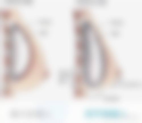 合肥市友好医院真实实例