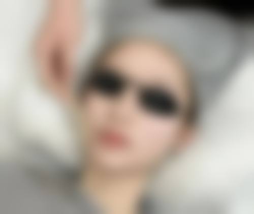 汕头附二医院激光点黑痣多少钱